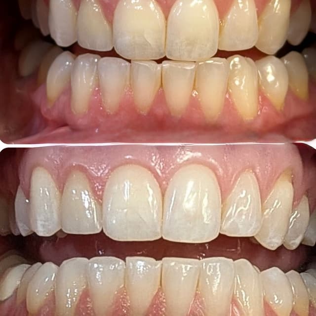 Teeth Whitening at Lisa’s Lil Spa Room in Sioux Falls, SD